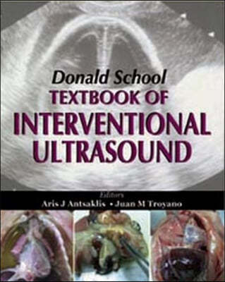 Donald School Textbook of Interventional Ultrasound