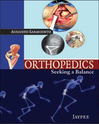 Orthopedics