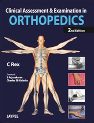 Clinical Assessment and Examination in Orthopedics