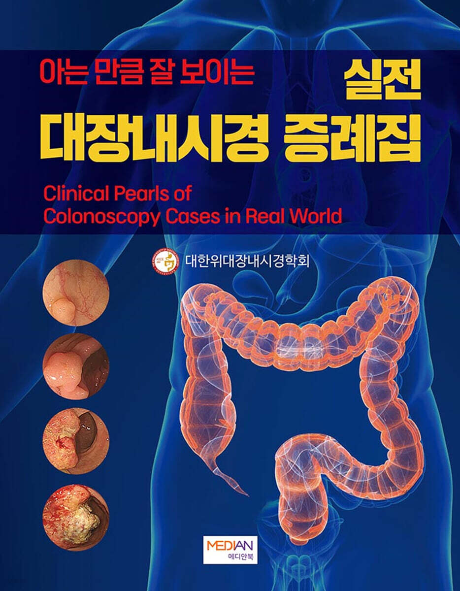 아는 만큼 잘 보이는 실전 대장내시경 증례집