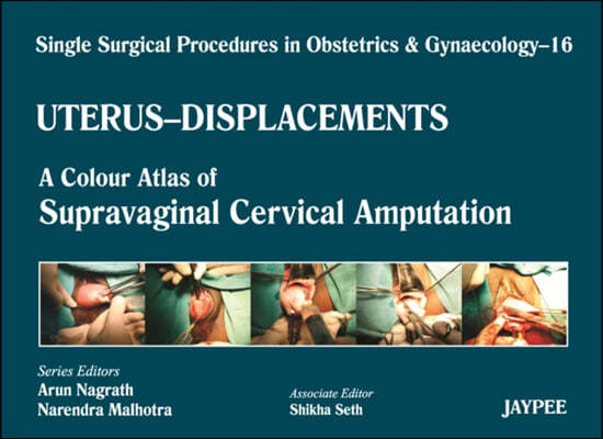 Uterus - Displacements