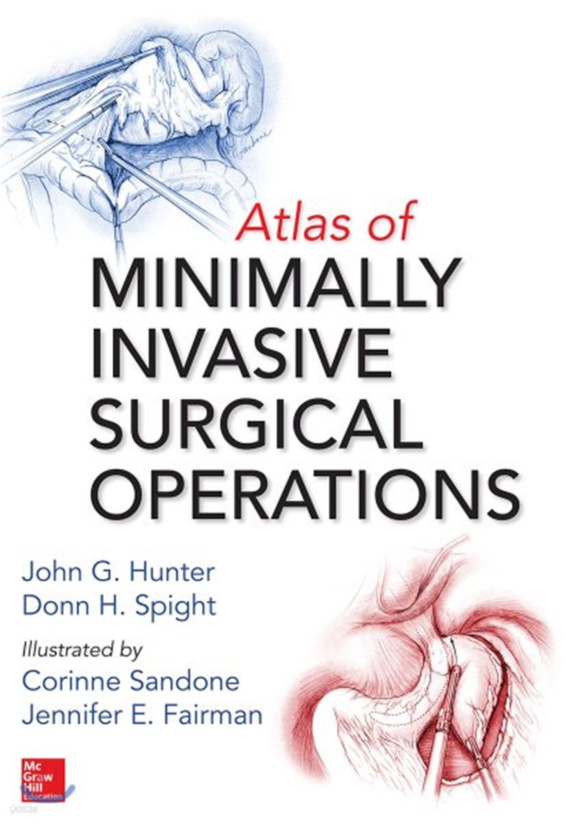 Atlas of Minimally Invasive Surgical Operations