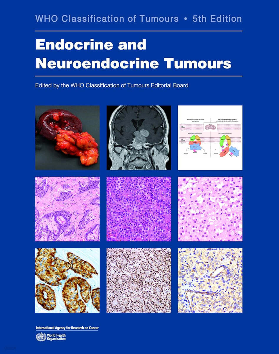 Endocrine and Neuroendocrine Tumours: Who Classification of Tumours, 5/E