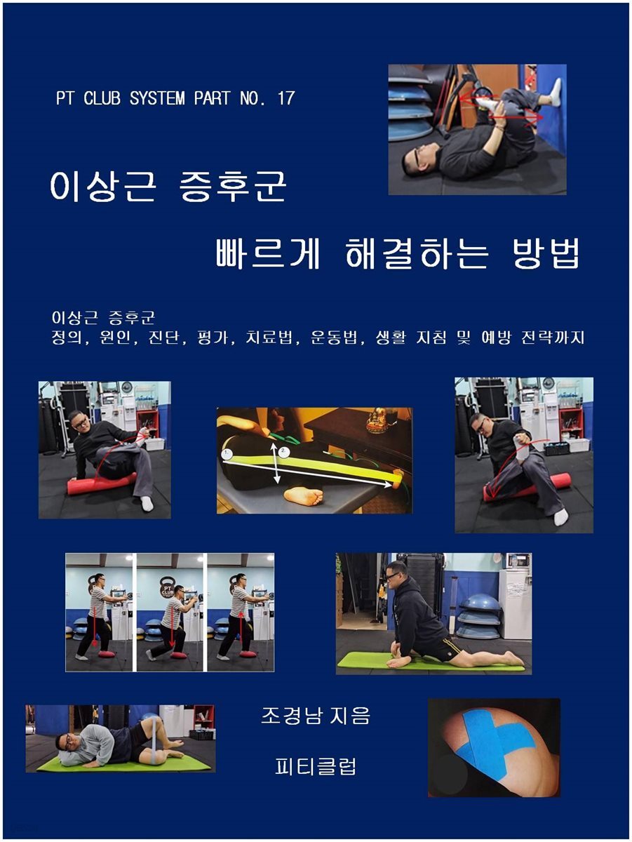 이상근 증후군 빠르게 해결하는 방법