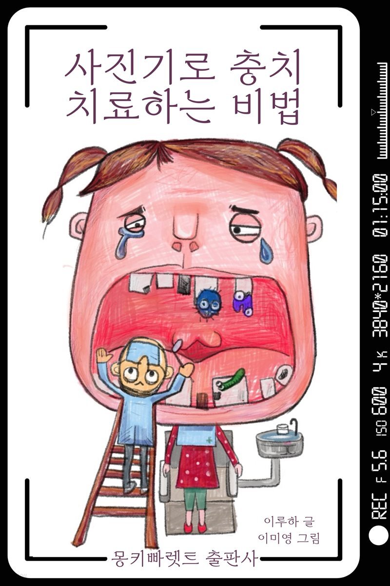 사진기로 충치 치료하는 비법