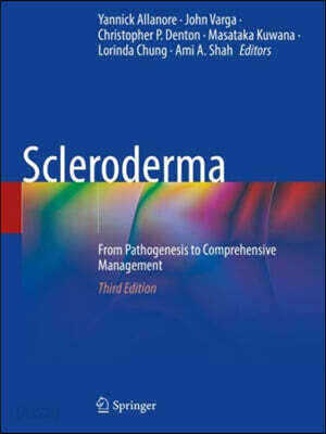 Scleroderma: From Pathogenesis to Comprehensive Management
