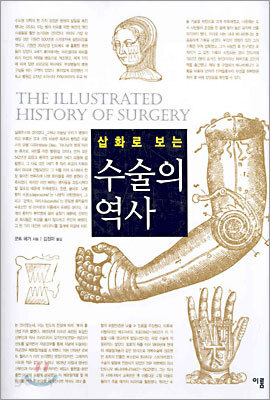 삽화로 보는 수술의 역사