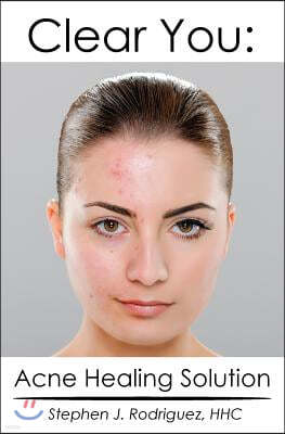 Clear You: Acne Healing Solution