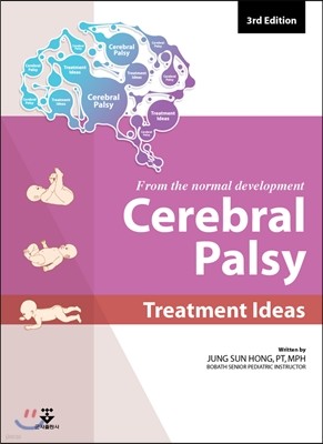 from the normal development Cerebral palsy