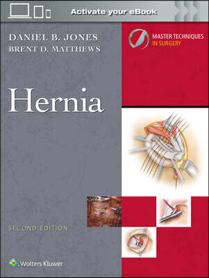 Master Techniques in Surgery: Hernia: Print + eBook with Multimedia