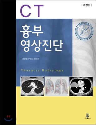 흉부영상진단CT