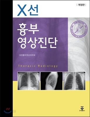흉부영상진단X선
