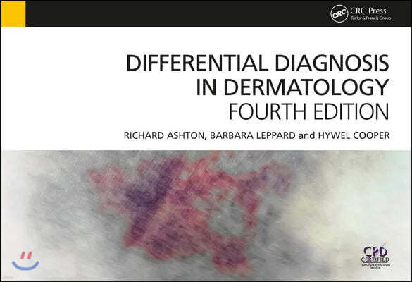 Differential Diagnosis in Dermatology