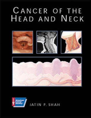 Cancer of the Head and Neck:ACS (Book with CD-ROM)