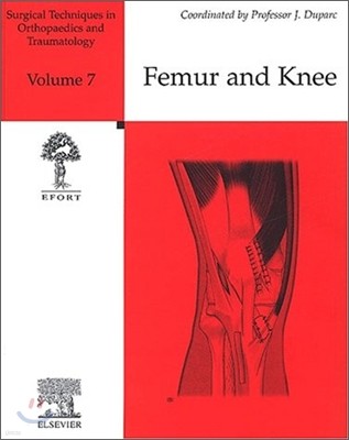Surgical Techniques in Orthopaedics and Traumatology : Femur and Knee Vol.7