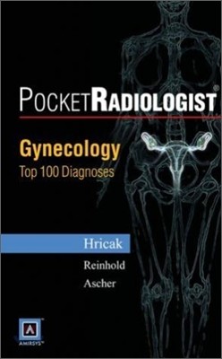 Pocketradiologist Gynecology : Top 100 Diagnoses