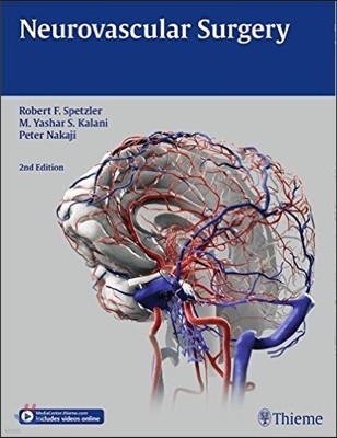 Neurovascular Surgery