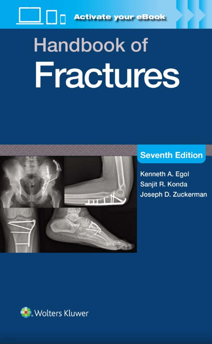 Handbook of Fractures: Print + eBook with Multimedia, 7/E