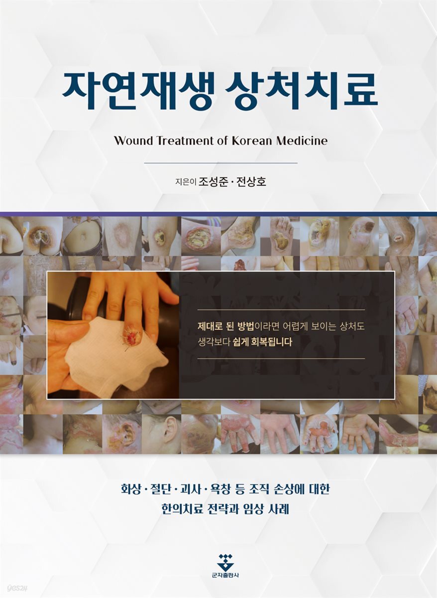 자연재생 상처치료