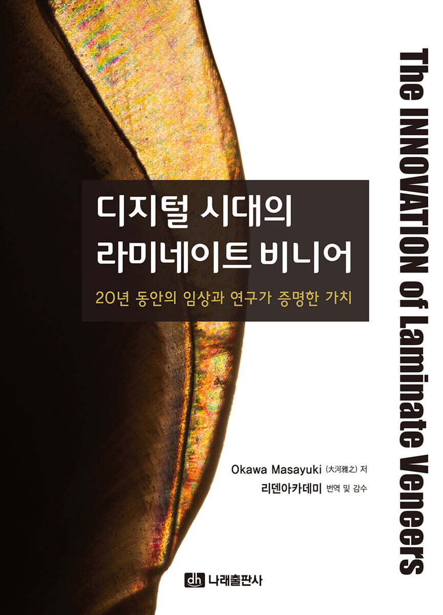 디지털 시대의 라미네이트 비니어
