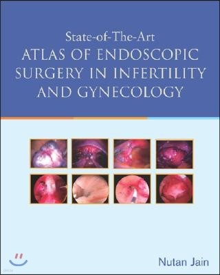 State of the Art Atlas of Endoscopic Surgery in Infertility and Gynecology