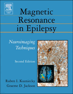 Magnetic Resonance in Epilepsy: Neuroimaging Techniques