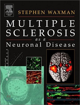 Multiple Sclerosis as a Neuronal Disease