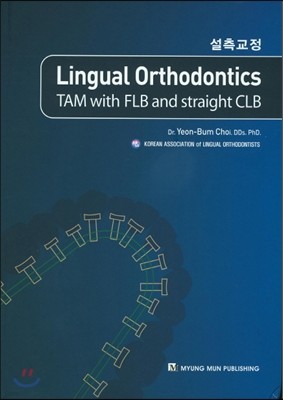 Lingual Orthodontics() TAM with FLB and straight CLB