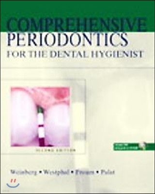 Comprehensive Periodontics For The Dental Hygienist, 2/E