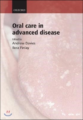 Oral Care in Advanced Disease