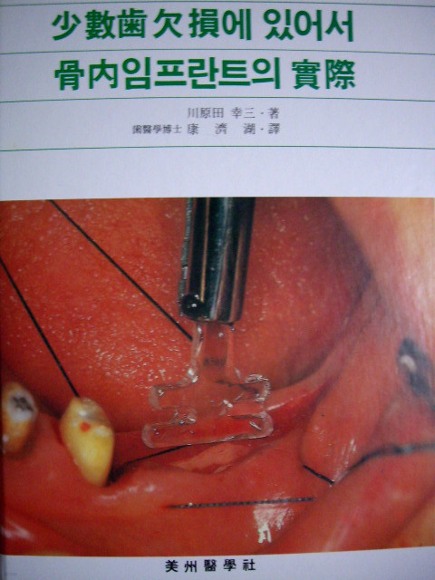 少數齒 欠損에 있어서 骨內 임프란트의 實際 (양장)