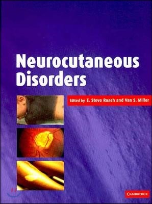 Neurocutaneous Disorders