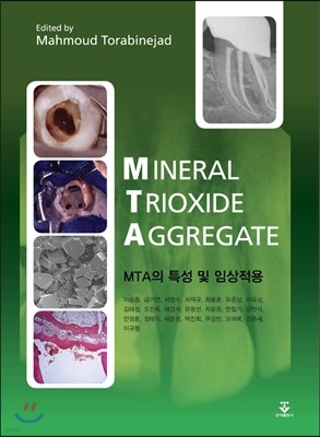 MTA의 특성 및 임상적용