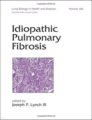 Idiopathic Pulmonary Fibrosis