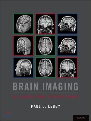 Brain Imaging: A Guide for Clinicians