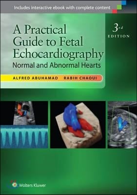 [ؿֹ] A Practical Guide to Fetal Echocardiography