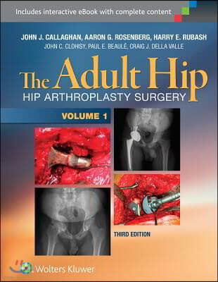 The Adult Hip (Two Volume Set): Hip Arthroplasty Surgery