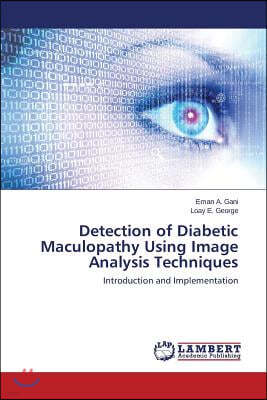 Detection of Diabetic Maculopathy Using Image Analysis Techniques