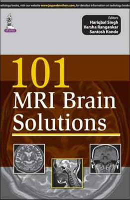 101 MRI Brain Solutions
