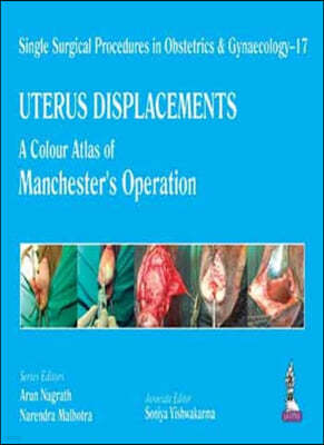 Uterus Displacements