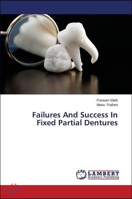 Failures And Success In Fixed Partial Dentures