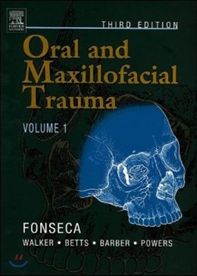 Oral And Maxillofacial Trauma