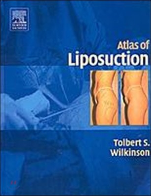 Atlas Of Liposuction