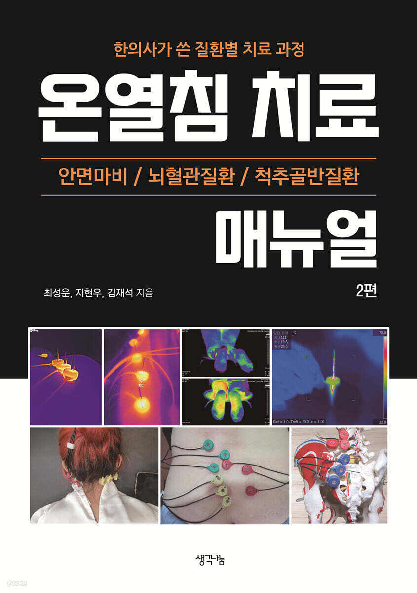 온열침 치료 매뉴얼 2편