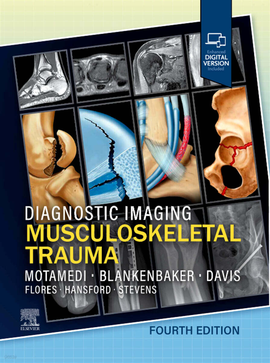 Diagnostic Imaging: Musculoskeletal Trauma, 4/E
