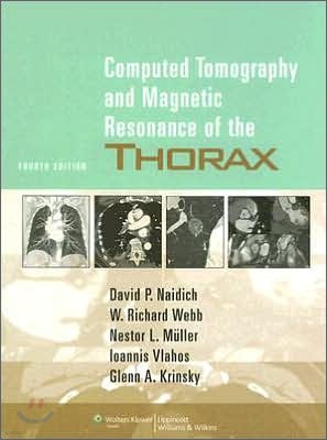 Computed Tomography and Magnetic Resonance of the Thorax, 4/E