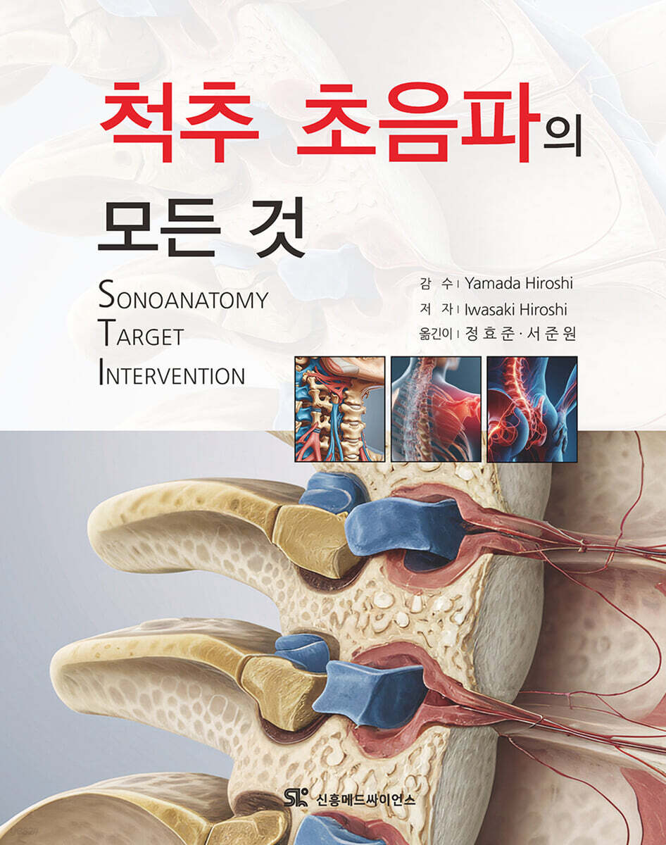 척추 초음파의 모든것