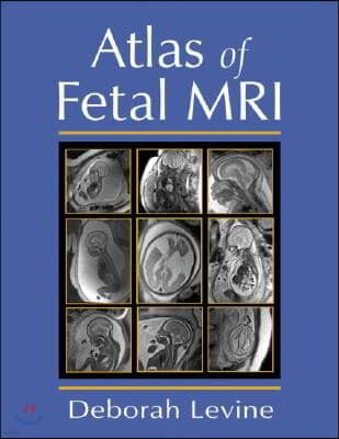 Atlas of Fetal MRI