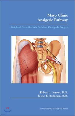 Mayo Clinic Analgesic Pathway