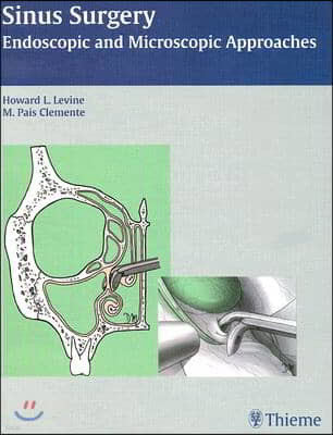 Sinus Surgery: Endoscopic and Microscopic Approaches